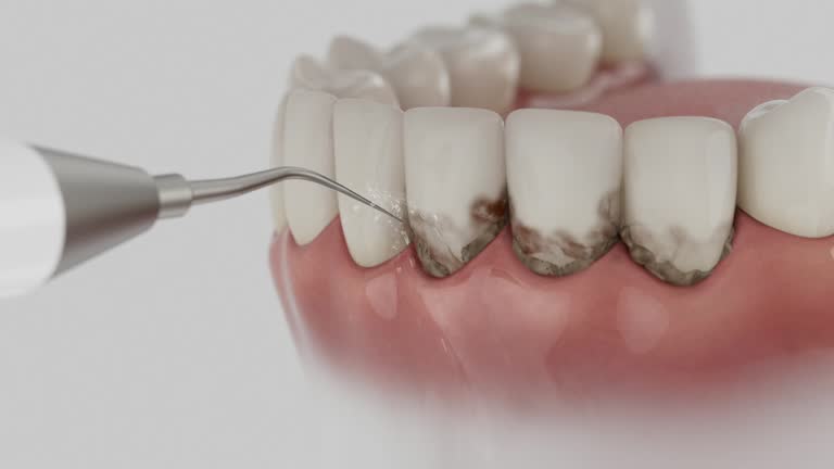 Trusted Tooth Extraction service in Manchester, WA - Dentist Open Now